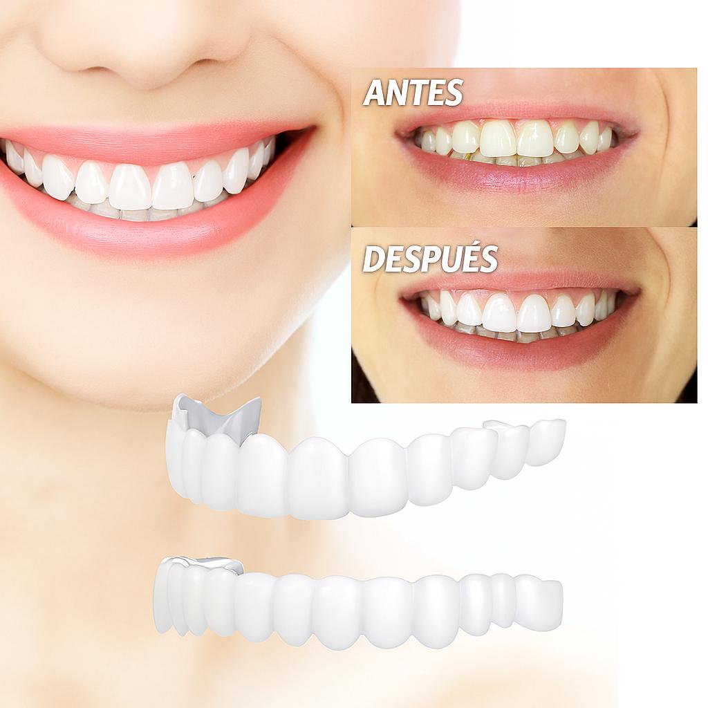 CoverSmile Sonrisa Perfecta – Tu sonrisa renovada en minutos